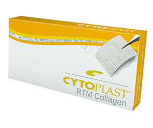 Аугментация НКР — Ксеногенные материалы — фото