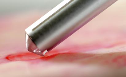 Костные скребки — фото-516_1